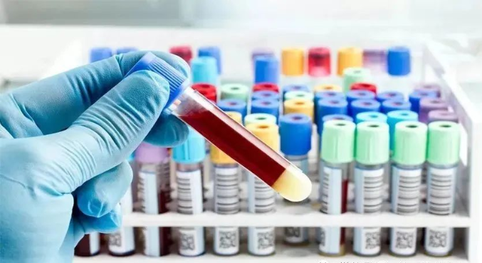 親子鑒定樣本放了一段時間還能用嗎？