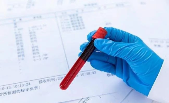 廣東司法親子鑒定大概多少錢？需要哪些手續(xù)？