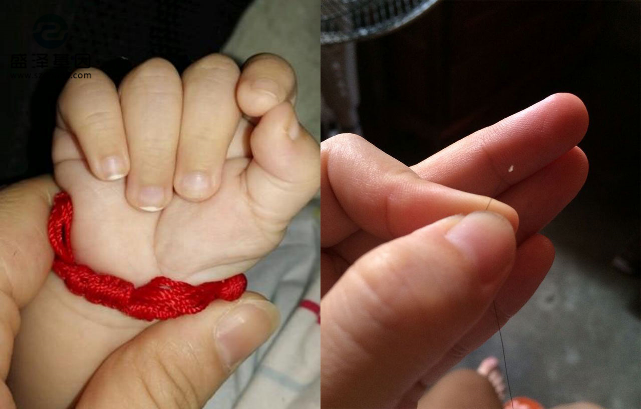 想偷偷采集毛發樣本做隱私親子鑒定怎么做？