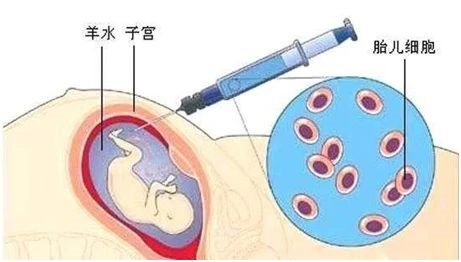 無創(chuàng)胎兒親子鑒定、羊水親子鑒定、毛發(fā)親子鑒定分別怎么做? 無創(chuàng)胎兒親子鑒定、羊水親子鑒定、毛發(fā)親子鑒定分別怎么做?