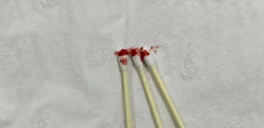 個(gè)人親子鑒定可以郵寄血樣檢材嗎？樣本有哪些注意事項(xiàng)？