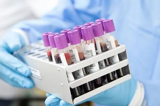 胎兒還沒有生下來能不能做親子鑒定采集羊水？