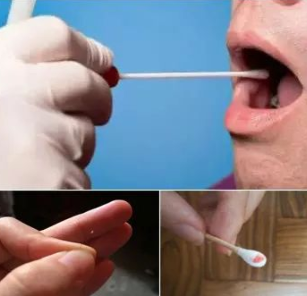 親子鑒定人可以自己在家取口腔棉簽樣本嗎？