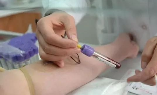 無創胎兒親子鑒定抽血需要孕婦空腹嗎? 無創胎兒親子鑒定抽血需要孕婦空腹嗎?