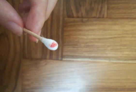 煙頭、血痕、毛發，做親子鑒定用哪些樣本最為準確？