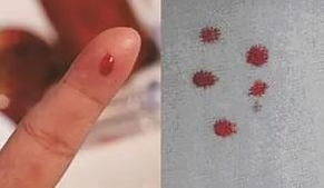 想帶小孩去做親子鑒定該如何取證呢?用紗布或棉簽等采集樣本 想帶小孩去做親子鑒定該如何取證呢?用紗布或棉簽等采集樣本