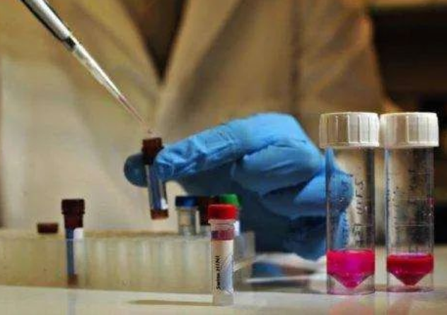 做親子鑒定到底是去醫院還是去有資質的正規親子鑒定機構？