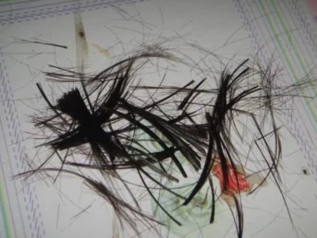 剪下來的頭發(fā)沒有毛囊可以做親子鑒定樣本嗎？