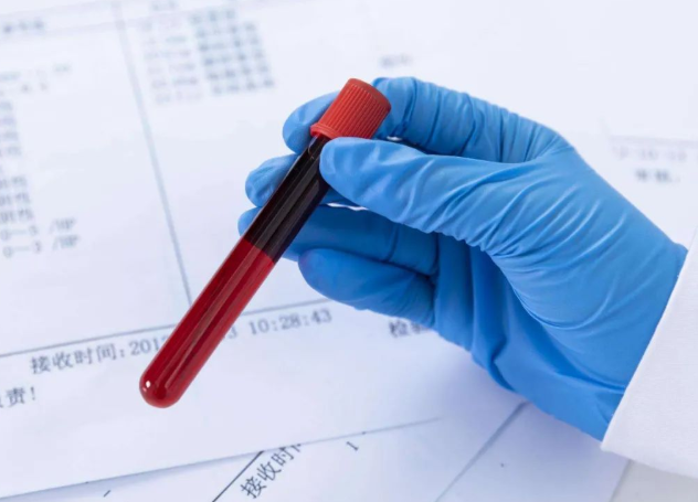 兄妹之間可以做親子鑒定嗎？兄弟之間可以做親緣關系鑒定嗎？