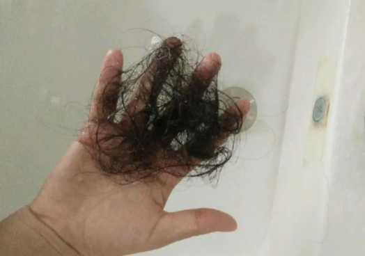 毛發(fā)可以做親子鑒定檢材嗎,怎么采集樣本才可以? 毛發(fā)可以做親子鑒定檢材嗎,怎么采集樣本才可以?