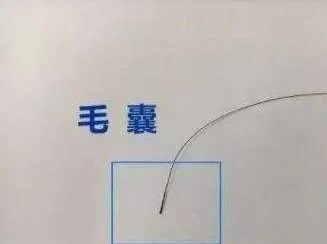 毛發(fā)可以做親子鑒定檢材嗎,怎么采集樣本才可以? 毛發(fā)可以做親子鑒定檢材嗎,怎么采集樣本才可以?