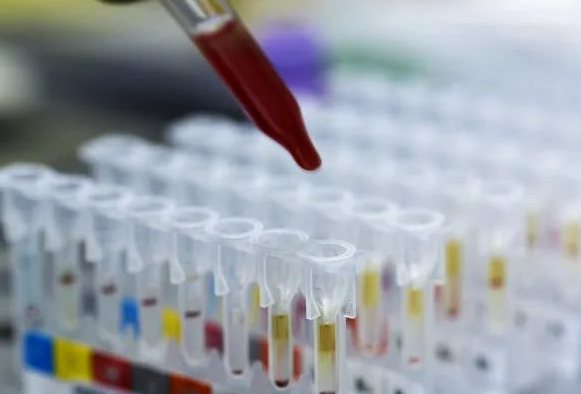 DNA親子鑒定會出錯嗎？根據樣本檢測位點出錯的概率是多少呢？