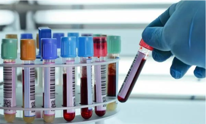 香港Y化驗（孕期驗血）-驗血查男女檢測原理是