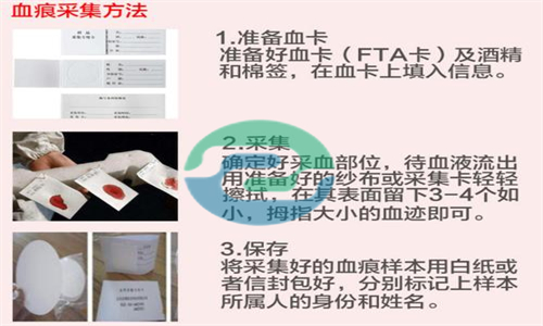 保險(xiǎn)繼承需要做中山DNA親子鑒定？