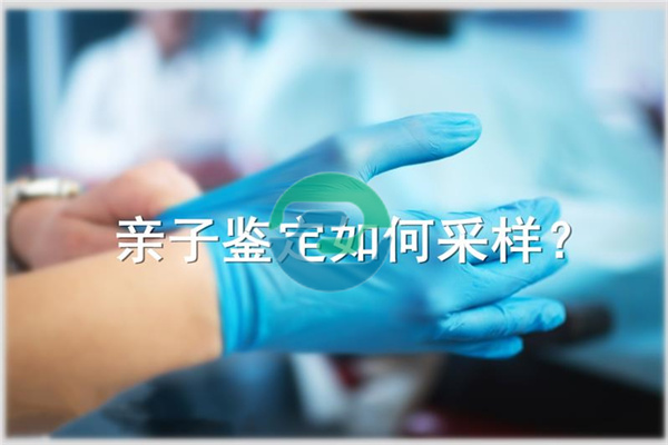 中山親子鑒定和親緣鑒定是一樣的嗎？